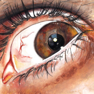 Eye 1
